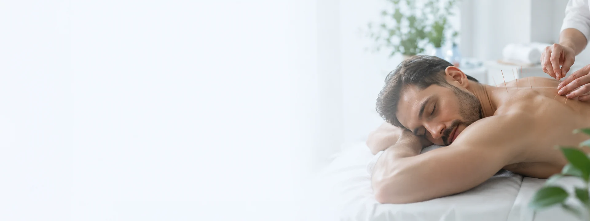 Acupuncture therapy session for natural pain relief and relaxation